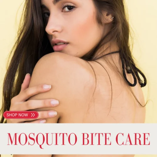 mosquito bite treatment donkey milk